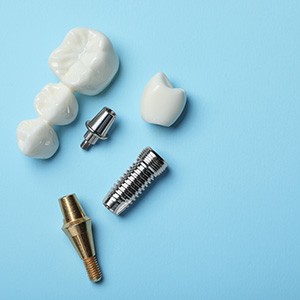 Dental bridges and dental implants are alternative tooth restorations to dentures