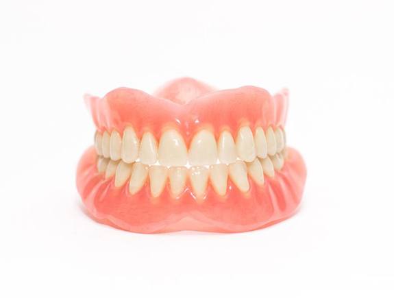 Model of an implant denture