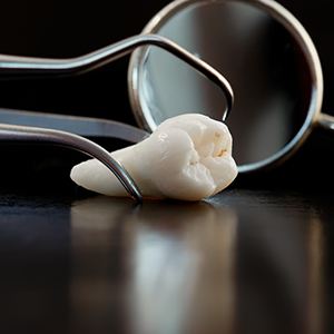 Close-up of extracted tooth, forceps, and dental mirror