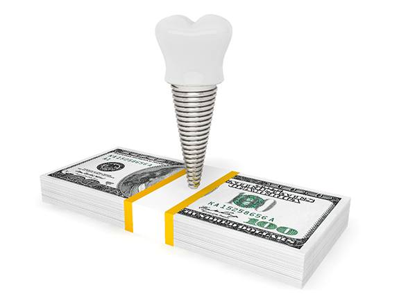 Dental implant on a pile of money