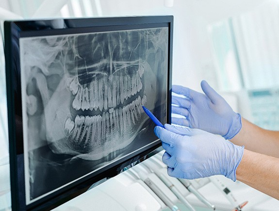 a dentist pointing at an X-ray being displayed on a screen