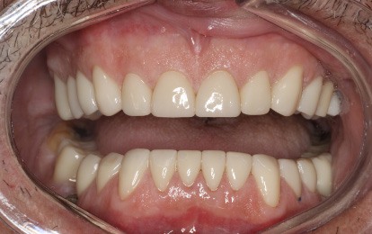 photo of after the smile
