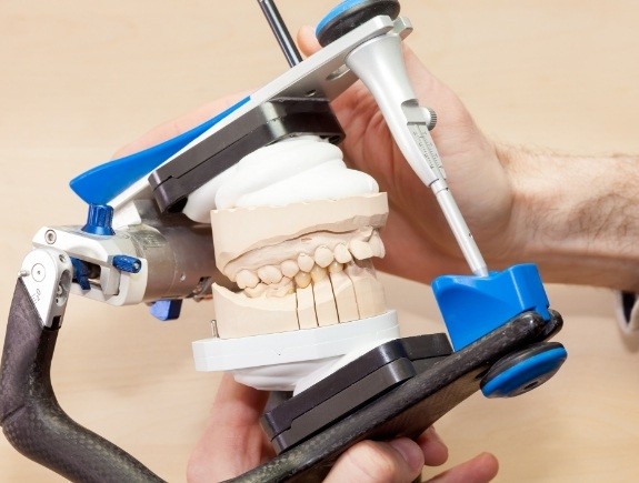 Dentist holding a model of the jaws