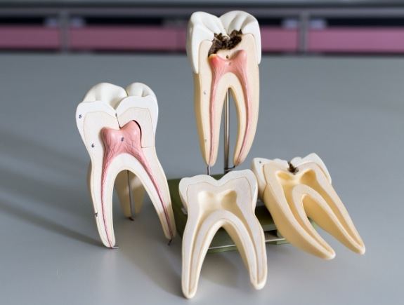 Several models of the teeth showing the inner root and nerve pathways