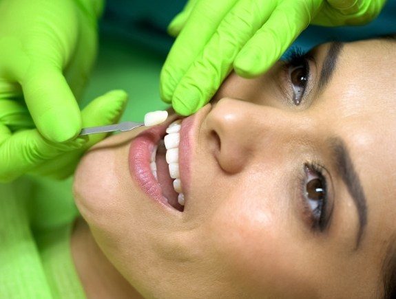 Cosmetic dentist placing a veneer on the tooth of a dental patient